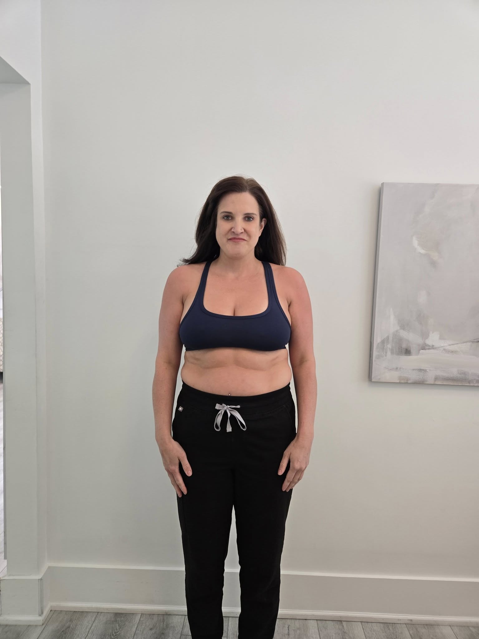 Before photo - front view